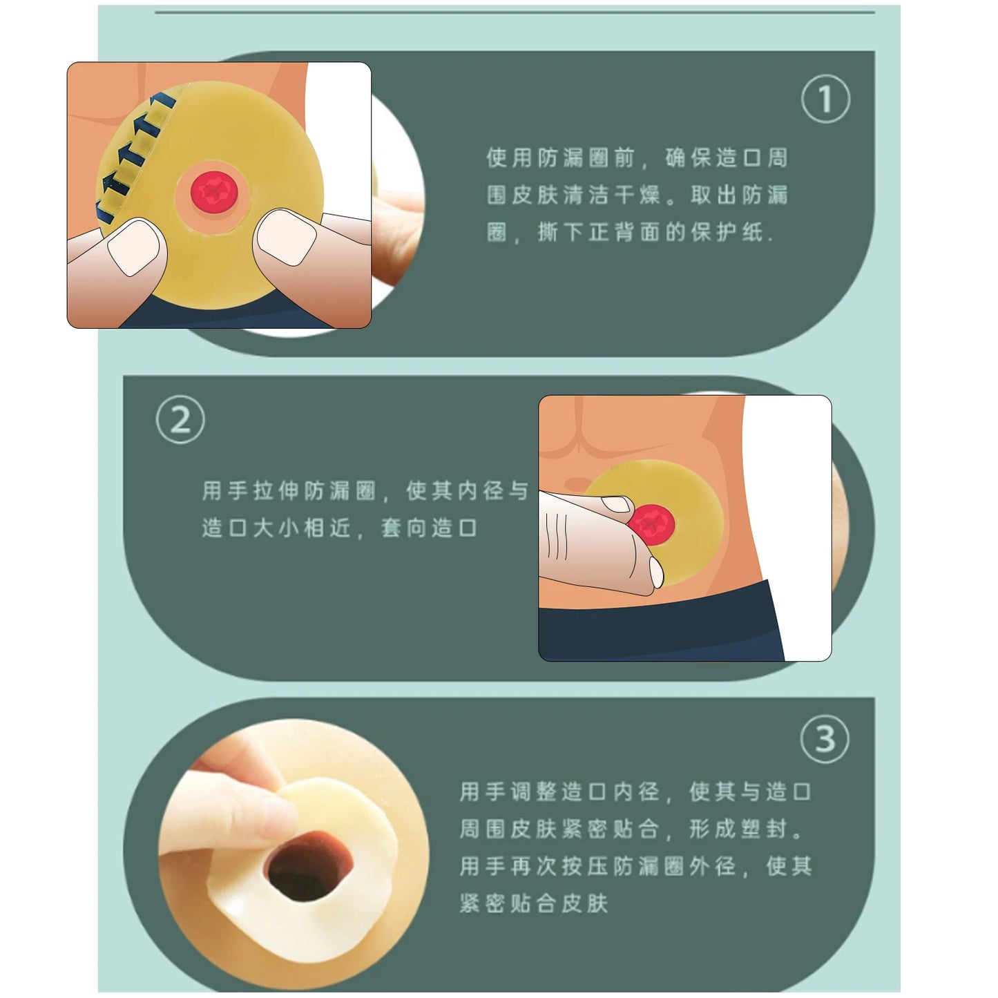 10PCS Ostomy Barrier Rings-Outer Diameter: 2" (50mm) 2mm Thickness Compatible with All Bag Types and Brands