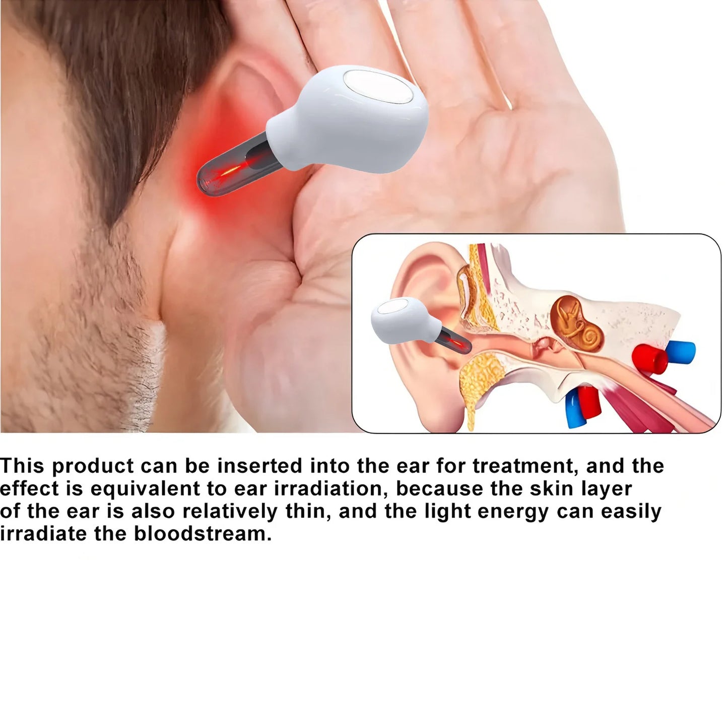 Tinnitus Ear Laser Therapy Irradiation Laser Physical Earplug Otitis Media Assist in the treatment of Deafness Treatment