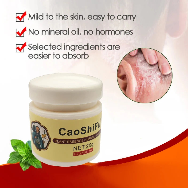 20g Psoriasis Cream Dermatitis Eczematoid Treatment Antibacterial Ointment Effective Body Anti-Itch Health Skin Care Products