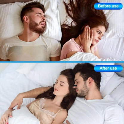 30/90/150Pcs,Better Sleep Anti-Snoring Nasal Strips, Nose Strips for Breathing, Physical Expansion Breath Nasal Patch