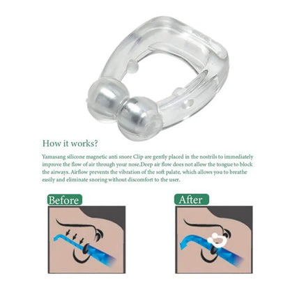 Anti Snoring Device To Stop Snoring Nose Clip For Easy Breathing Improvement Sleep Assistance Apnea 1pc 2pc 4pc 6pc 8pc At Night