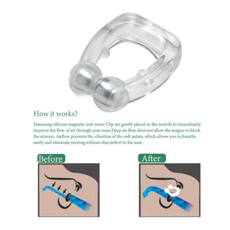Anti Snoring Device To Stop Snoring Nose Clip For Easy Breathing Improvement Sleep Assistance Apnea 1pc 2pc 4pc 6pc 8pc At Night
