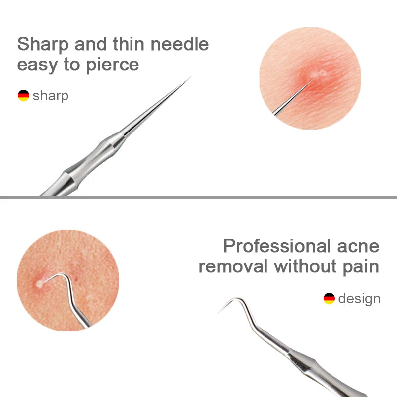 New German Blackhead Clip Tweezers Acne Blackhead Removal Needles Pimples Beauty Artifact Blemish Extractor Remover Needle Tool