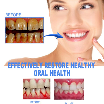 Damaged Gum Repair Care Gel Deep Cleaning Effectively Removes Yellow Teeth Stains Tartar Fresh Breath Teeth Cleaning Gel 4ml