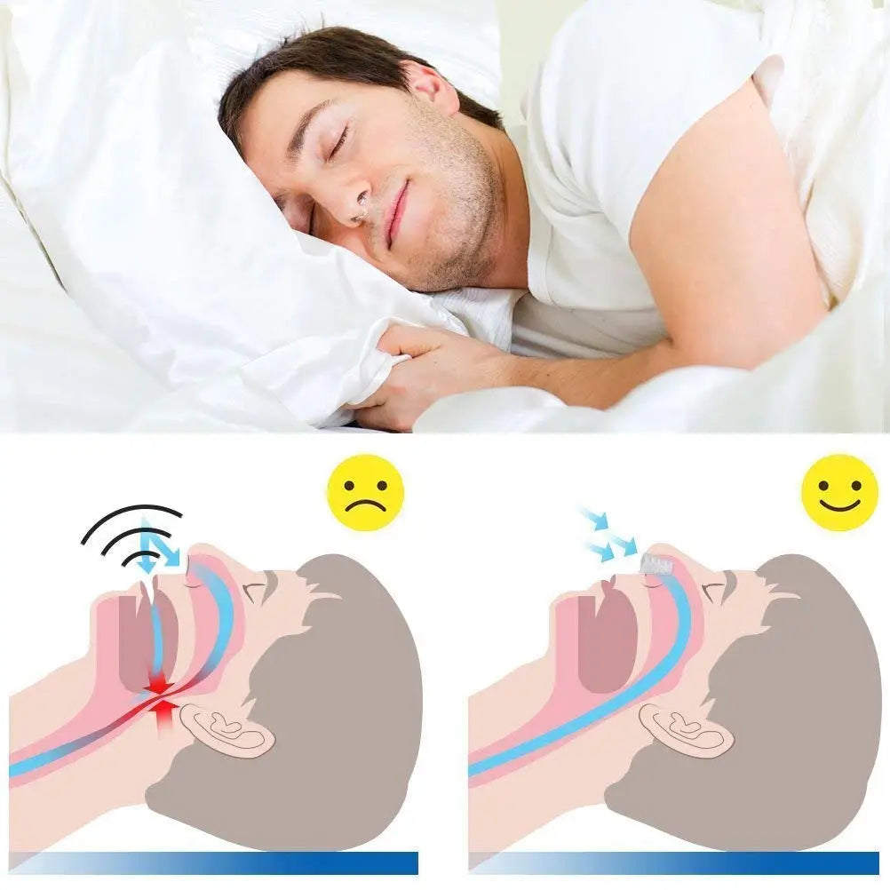 Hot Saling 2pcs Snoring Anti Snore Sleep Aid Device Ease Breathing Silicone Nasal Dilator