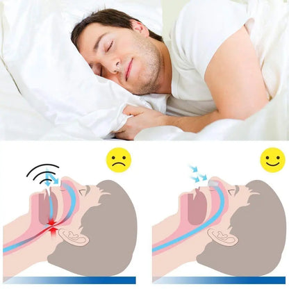 Hot Saling 2pcs Snoring Anti Snore Sleep Aid Device Ease Breathing Silicone Nasal Dilator