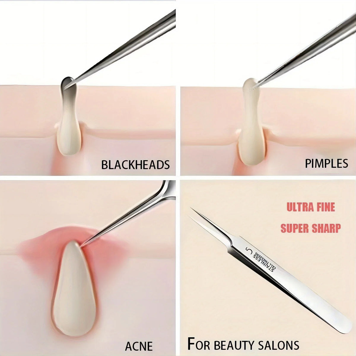 Stainless Steel Ultra-fine No. 5 Cell Pimples Blackhead Clip Tweezers Beauty Salon Scraping Closing Special  Acne Needle Tools