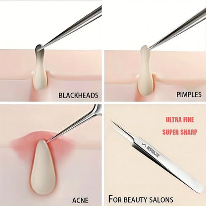 Stainless Steel Ultra-fine No. 5 Cell Pimples Blackhead Clip Tweezers Beauty Salon Scraping Closing Special  Acne Needle Tools