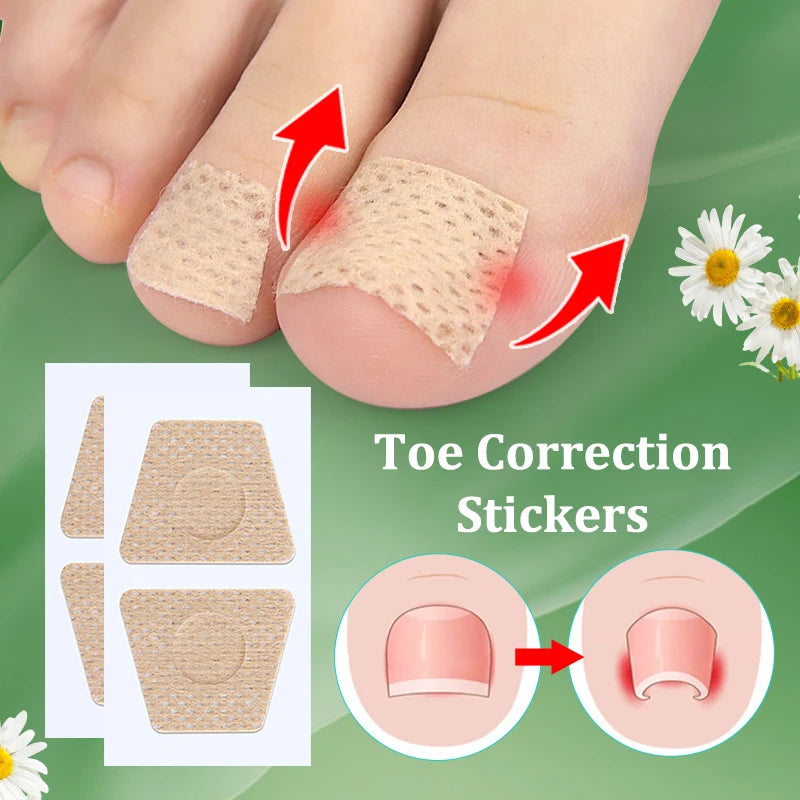 2/6/12Pc Ingrown Toenail Toe Correction Stickers Nail Art Foot Patches Feet Care Paronychia Treatment Recover Pedicure Foot Tool