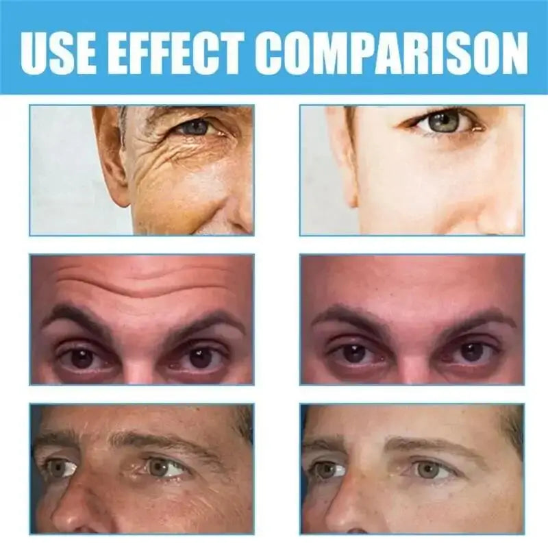 Retinol Eye Bag Removal Cream For Men Anti-Wrinkle Firming Skin Fades Fine Lines Anti Dark Circle Puffiness Brightening Eye Care