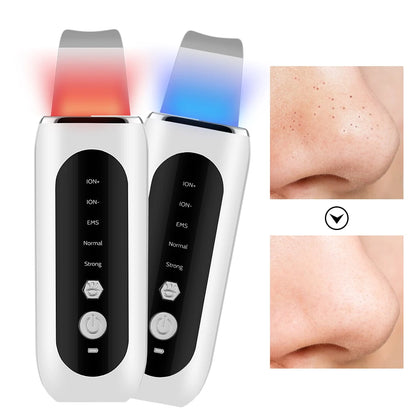 Ultrasonic Skin Scrubber Peeling Blackhead Remover Deep Face Cleaning Ultrasonic Ion Ance Pore Cleaner Facial Shovel Cleanser