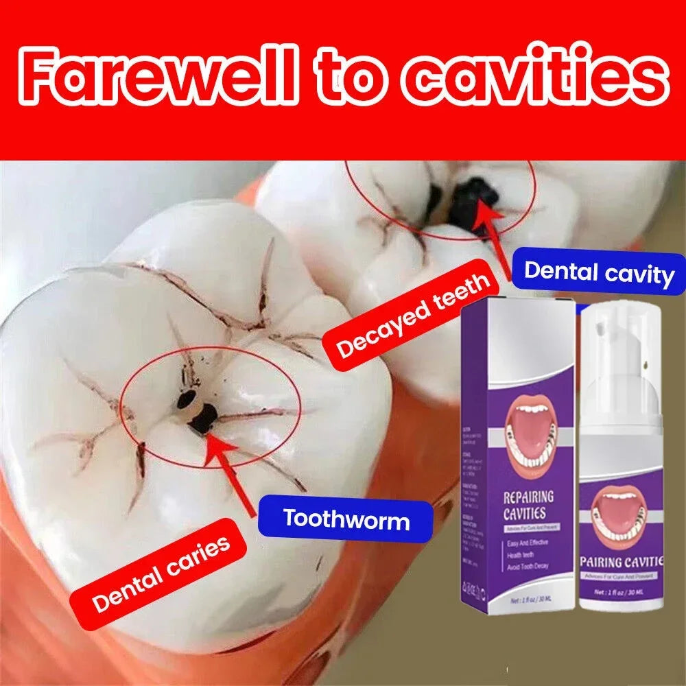 Effective Teeth Whitening Tooth decay repair  Calculus Plaque Periodontitis Remove Cavities