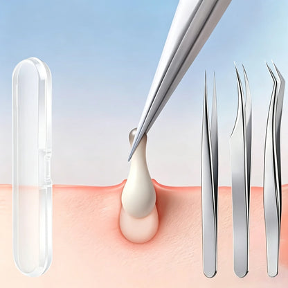 3pcs Professional Blackhead Tweezers - Ultra-Thin Tip, Stainless Steel Tweezers for Whiteheads, Ingrown Hairs And Facial Removal