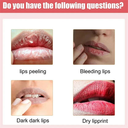 Fast Lightening Pink Mouth Lips Serum Bleaching Permanent Remove Dark Smoke Lips Lip Balm Moisturize Gloss Lipstick Lip Oil