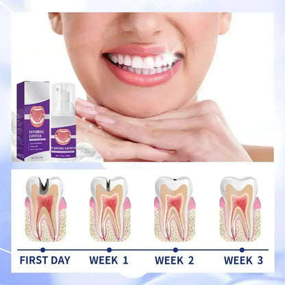Effective Teeth Whitening Tooth decay repair  Calculus Plaque Periodontitis Remove Cavities