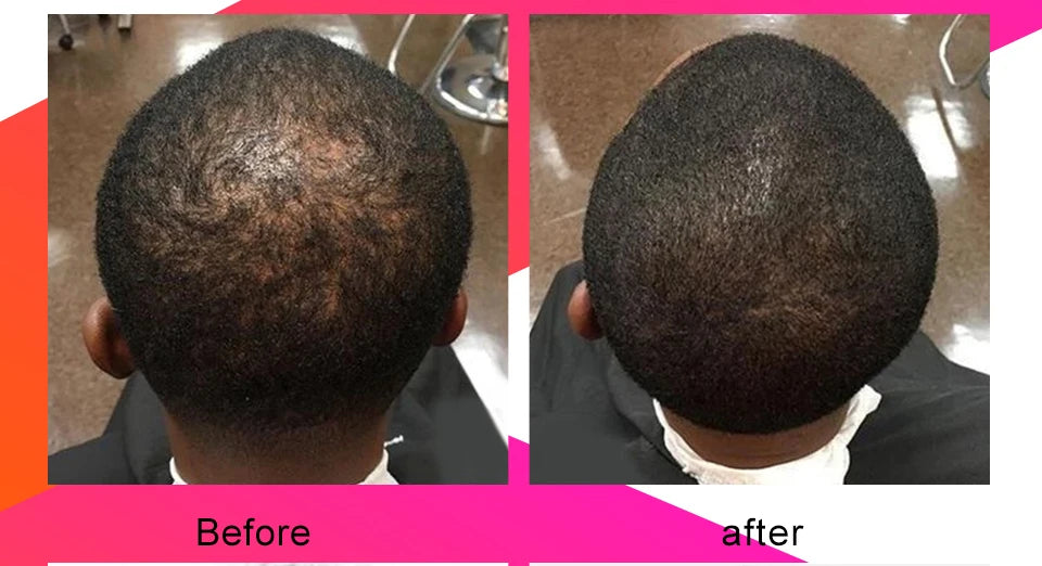 10ml Chebe Spray Fast Hair Growth Oil Hair Loss Treatment Traction Alopecia Spray Repair Damage Anti Hair Break Hair Care Spray