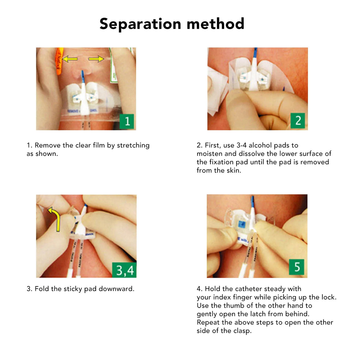 Catheter Tube Holder Catheter Stabilization Device PU Disposable Butterfly Shape Adhesive Urinary Legband Sticker