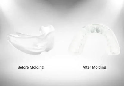 1Set Stop Snoring Anti Snore Mouthpiece Apnea Guard Bruxism Tray Sleeping Aid Mouthguard Anti Snore Sleep Adi Device Health Care