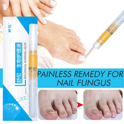 High-end Nail Care Pen Toenail Repair Pen With Natural Ingredients Nail Beauty Health Nail Repair Essence Gentle Care Tool