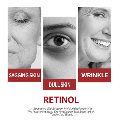 Retinol Collagen Face cream Complex Day Night Cream Hyaluronic acid Reduce fine lines dark circles moisturize firm pores