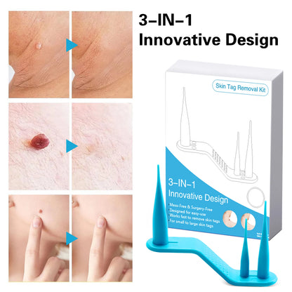 2-IN-1 Innovative Skin Tag Remover Kit Micro Skin Tag Removal Device Adult Mole Stain Wart Remover Face Care Beauty Tools