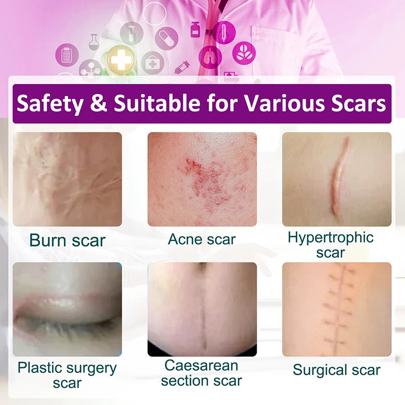 1.5M Silicone Scar Sheets Clear Scars Tape Strip Invisible Silicone Self-adhesive Patches for C-Section Surgery Keloid Burn Acne