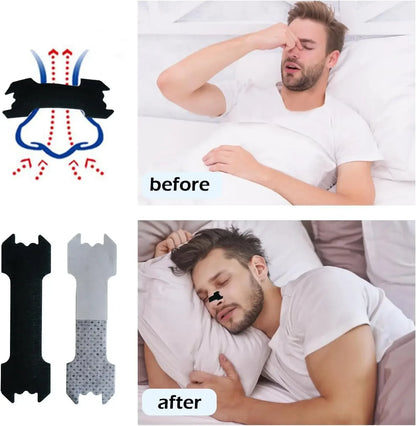 30/90/150PCS Enhanced Adhesion Sports Nasal Strips Breathable Comfortable Design Sleep Aid Non-Invasive Anti Snoring Nose Patch