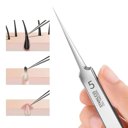 Stainless Steel Ultra-fine No. 5 Cell Pimples Blackhead Clip Tweezers Beauty Salon Scraping Closing Special  Acne Needle Tools