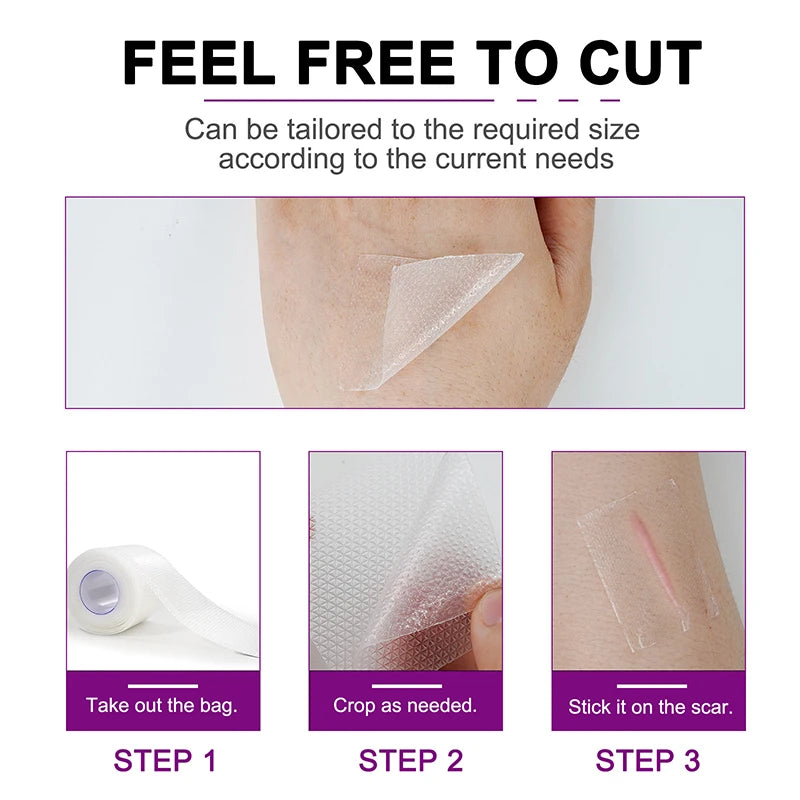 1.5M Silicone Scar Sheets Clear Scars Tape Strip Invisible Silicone Self-adhesive Patches for C-Section Surgery Keloid Burn Acne