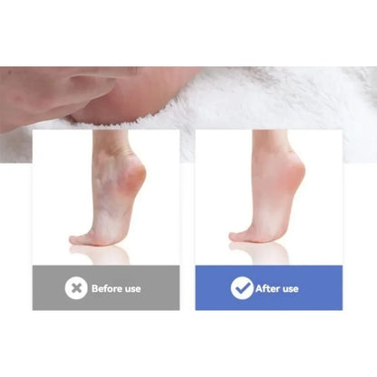 2pcs Feet Scraping Dead Skin Knife Foot Care Knife To Remove Dead Skin Knife Shaving Calluses To Remove Dead Skin Utensils