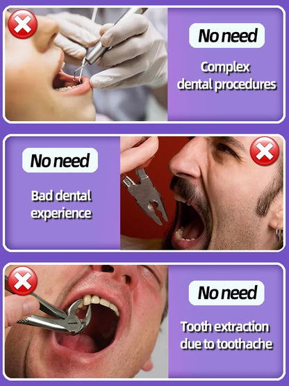 Tooth decay Repair Repairing Cavities Protecting Anti Caries