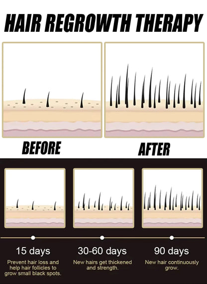 latest technology new products Anti-hair Loss Essence Promotes Hair Growth and Improves The Scalp Environment in 2026