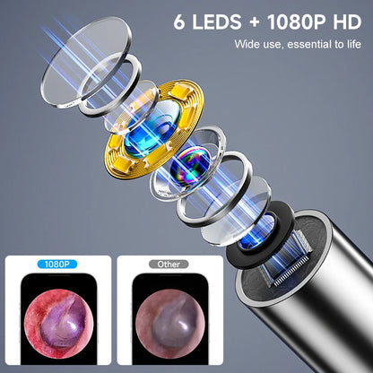 Visual WiFi Otoscope Camera 4.2mm 1080P HD Ear Picker for IOS/Android Ear Cleaning Wireless Endoscope with Ear Wax Removal Tools