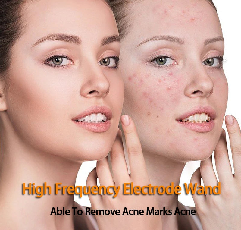 Replace HF Wand Spiral Electrode Glass Tube Argon Violet Ray Neon Acne Skin Care Face Body Massage