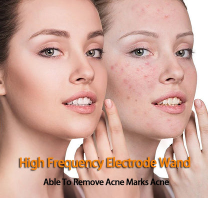 Replace HF Wand Spiral Electrode Glass Tube Argon Violet Ray Neon Acne Skin Care Face Body Massage