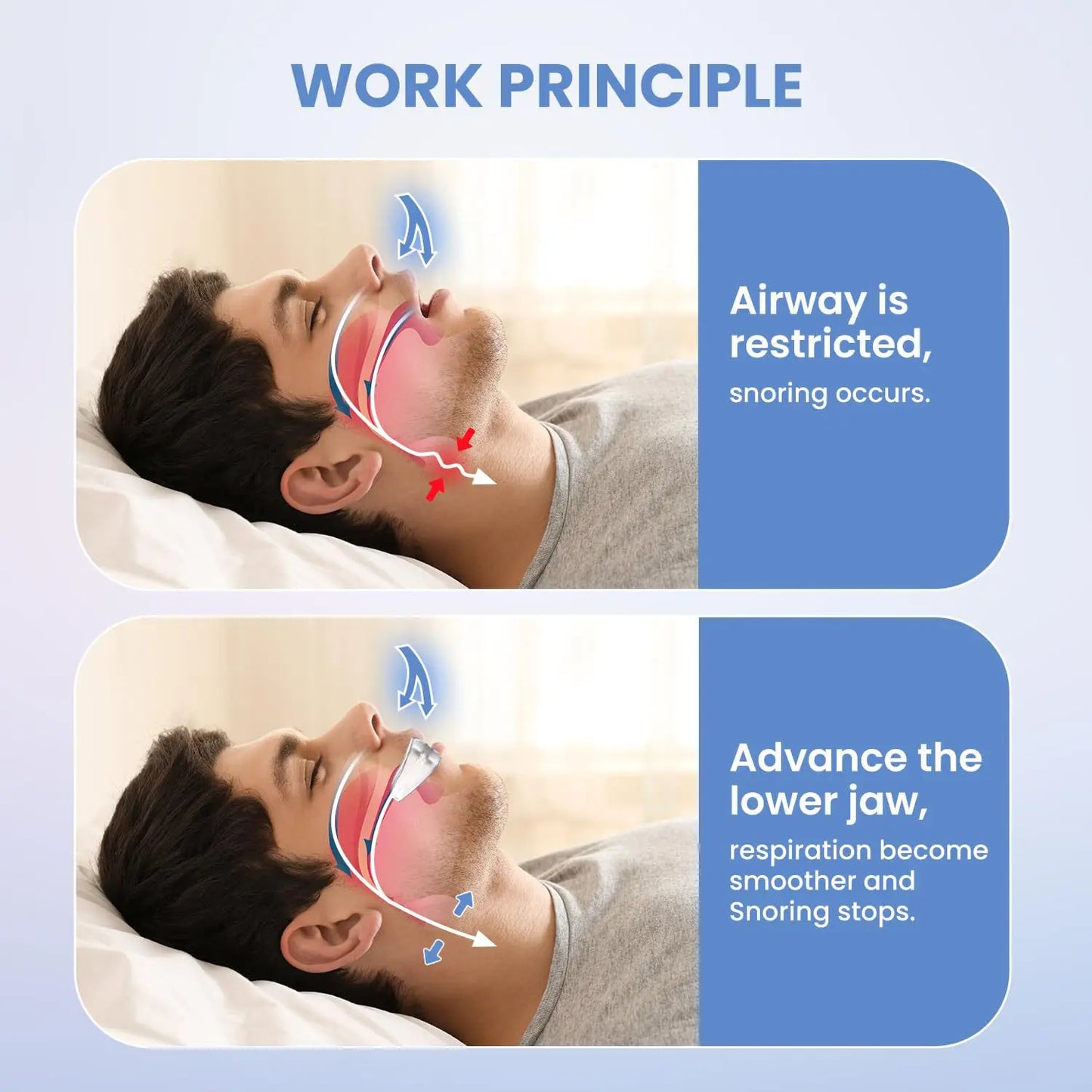 1Set Stop Snoring Anti Snore Mouthpiece Apnea Guard Bruxism Tray Sleeping Aid Mouthguard Anti Snore Sleep Adi Device Health Care