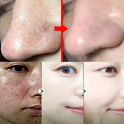 Original Facial Remove Blackhead Green Tea Solid Mask Treat Acne Blemish Black Dots Clean Stick Cream Shrink Pores Skin Care  ﻿