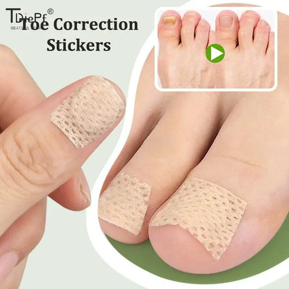 2/6/12Pc Ingrown Toenail Toe Correction Stickers Nail Art Foot Patches Feet Care Paronychia Treatment Recover Pedicure Foot Tool