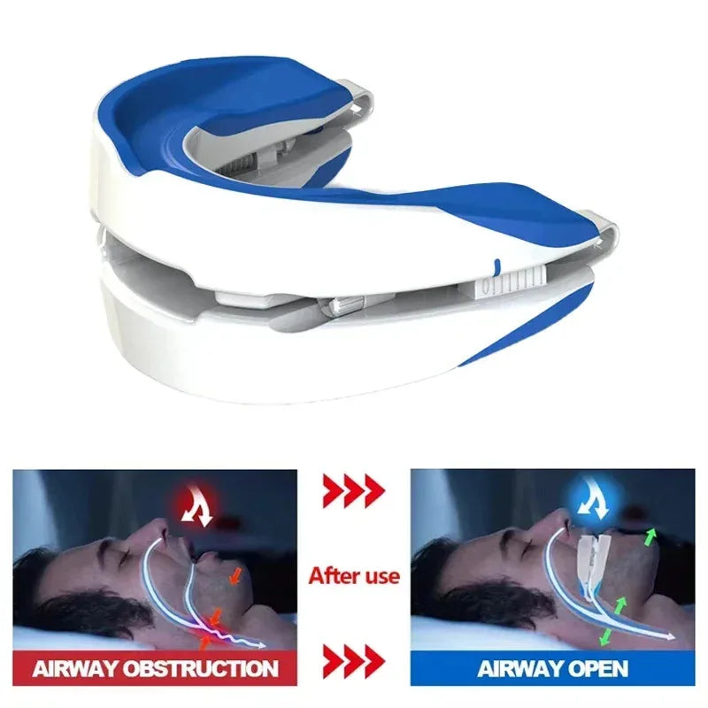 Adjustable Anti-Snoring Mouthpiece Nighttime Teeth Guard Sleeping Mouthguard for Bruxism Stop Snoring Device