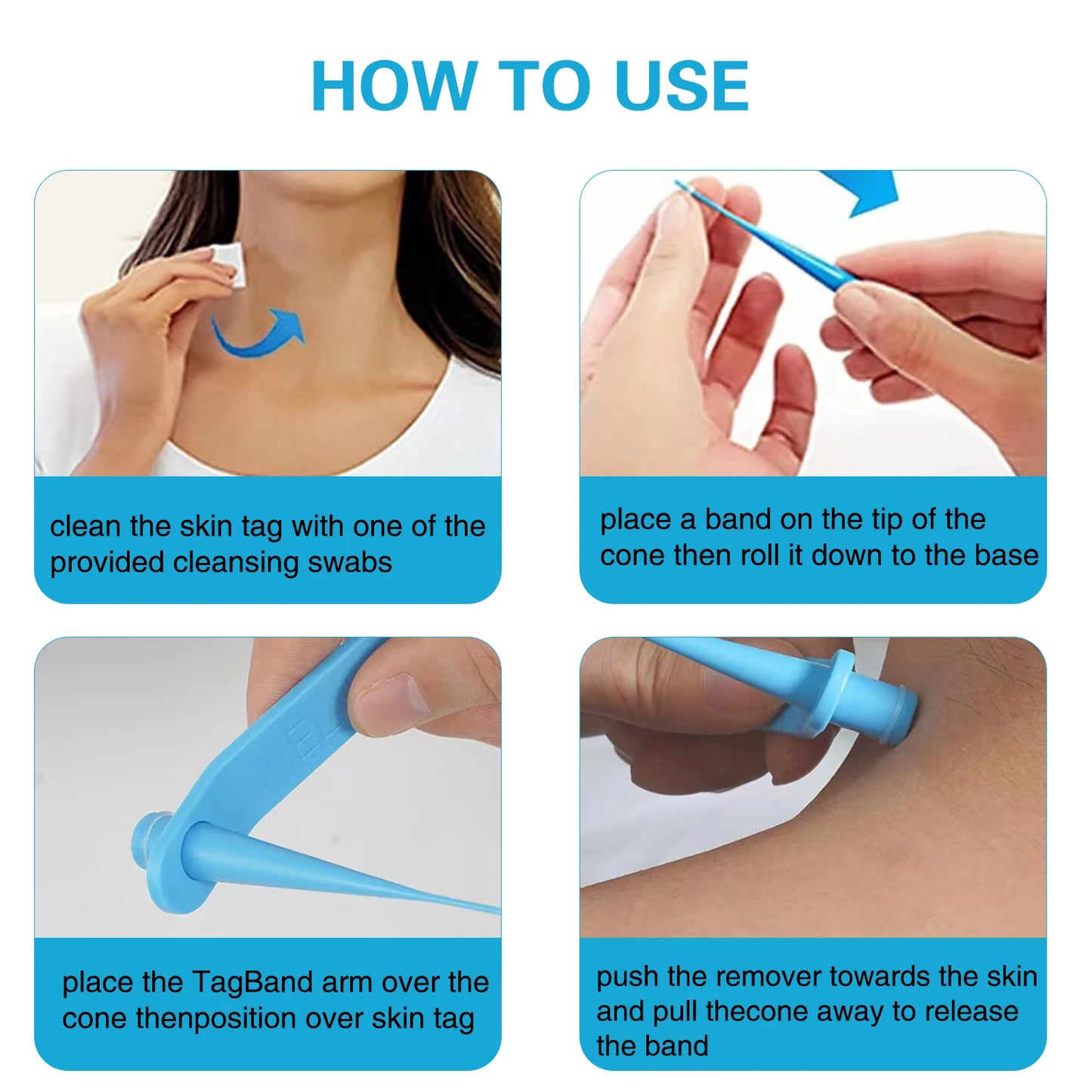 2-IN-1 Innovative Skin Tag Remover Kit Micro Skin Tag Removal Device Adult Mole Stain Wart Remover Face Care Beauty Tools