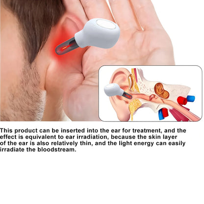 Tinnitus Ear Laser Therapy Irradiation Laser Physical Earplug Otitis Media Assist in the treatment of Deafness Treatment