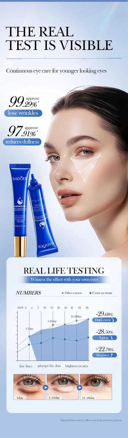 Caviar Eye Bag Removal Cream Hyaluronic Acid Anti-Wrinkle Firming Skin Fade Fine Lines Anti Dark Circle Puffiness Eye Care 20g