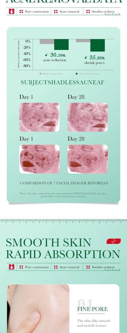 35ml BIOAOUA Salicylic Acid Anti-Acne Removal Essence Regulate Oil Secretion Improve Acne Of Skin Smooth Skin Blackhead Removal