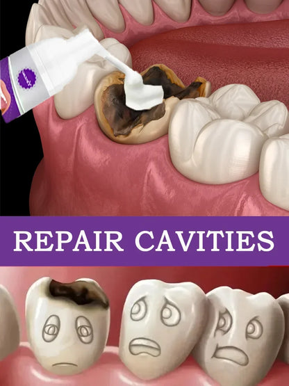 Tooth decay Repair Repairing Cavities Protecting Anti Caries