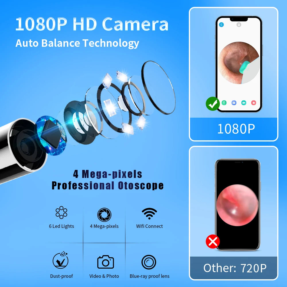 Smart Ear Wax Cleaner with Camera 3.5mm Earpick Otoscope Visual Ear Camera Health Care Ear Cleaner for iPhone, iPad, Android