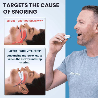 Adjustable Anti-Snoring Mouthpiece Nighttime Teeth Guard Sleeping Mouthguard for Bruxism Stop Snoring Device