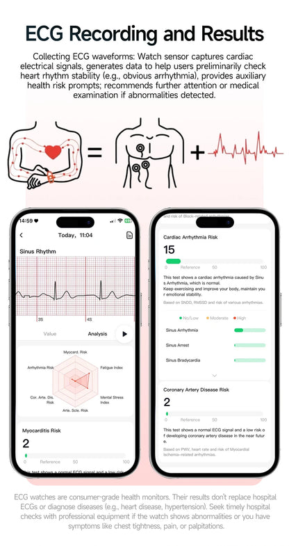 New Men Accurate Health Diagnosis ECG Smart Watch Blood Pressure Blood Oxygen Blood Fat Uric Acid Temp Bluetooth call Smartwatch