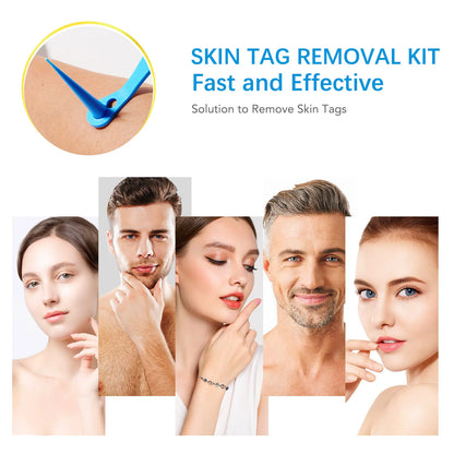 2-IN-1 Innovative Skin Tag Remover Kit Micro Skin Tag Removal Device Adult Mole Stain Wart Remover Face Care Beauty Tools