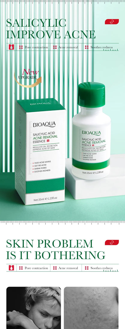 35ml BIOAOUA Salicylic Acid Anti-Acne Removal Essence Regulate Oil Secretion Improve Acne Of Skin Smooth Skin Blackhead Removal