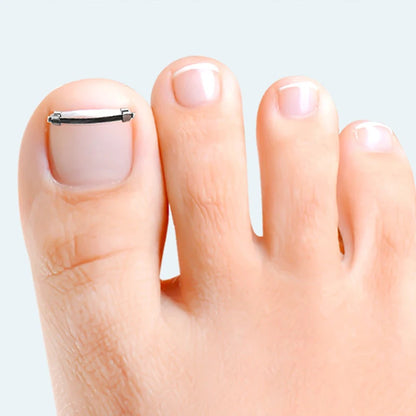 Ingrown Toenail Pedicure Tool Embed Toe Nail Care Straightening Correction Clip Curved Clamp Toenails Correction Tool For Toes